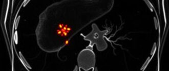 Как подготовиться к КТ печени: понятная инструкция без нервов